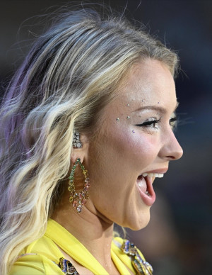 photos Zara Larsson